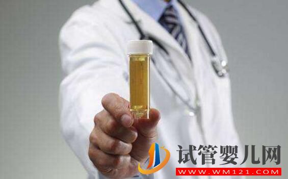 試管嬰兒檢查報(bào)告有效期是多長(zhǎng)？各項(xiàng)檢查都一樣嗎(圖3)