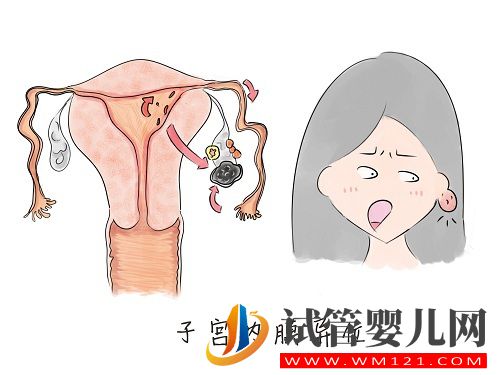 子宮內膜異位癥——痛經的一種常見病因(圖2)