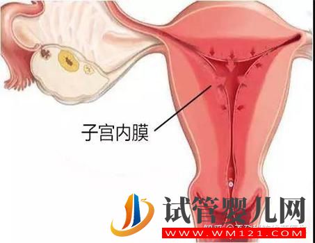 子宮內(nèi)膜異位癥有這4種類型,難怪癥狀不一樣(圖3)