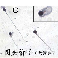 一代試管和二代試管的區(qū)別_畸形率高影響試管成功率(圖14)