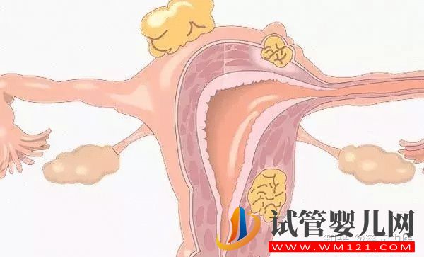 閉經(jīng)是由什么原因引起的呢？閉經(jīng)又和絕經(jīng)有什么區(qū)別？(圖6)