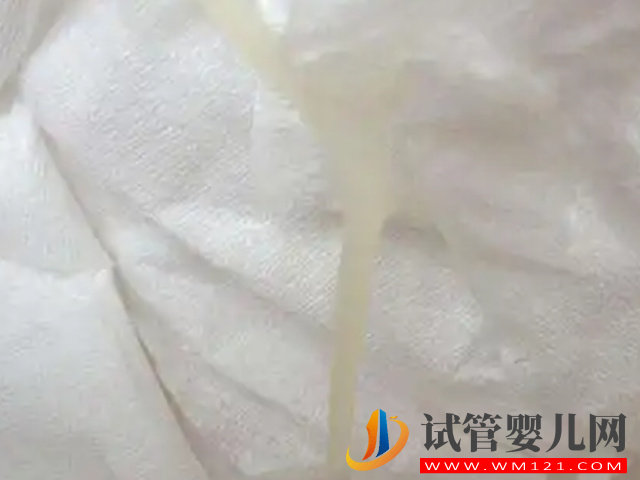 一圖看清胚胎著床成功排出的白帶表現(xiàn)，呈水樣、發(fā)黃都是好“孕”(圖2)