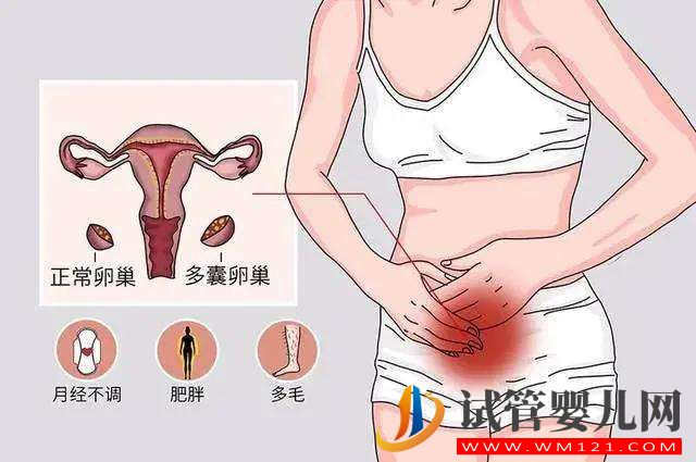 戰勝多囊的三大法寶，迎接好孕(圖1)