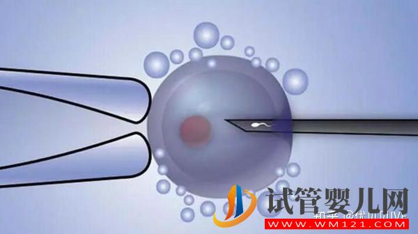 國內排名靠前的三代試管醫院都有哪些_第一梯隊了解下(圖1)
