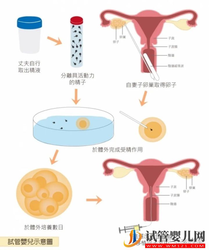 一篇文章看懂輔助生殖(圖4)