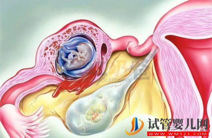 養囊有什么好處_哪些情況推薦養囊(圖1)