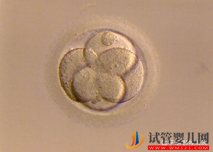 養囊主要看精子質量嗎(圖1)