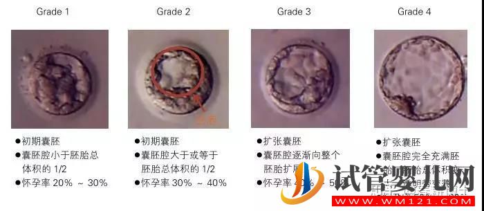 要不要養囊胚,如何提高養囊成功率(圖1)