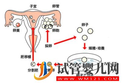 試管適應(yīng)癥_第一代試管嬰兒(圖3)