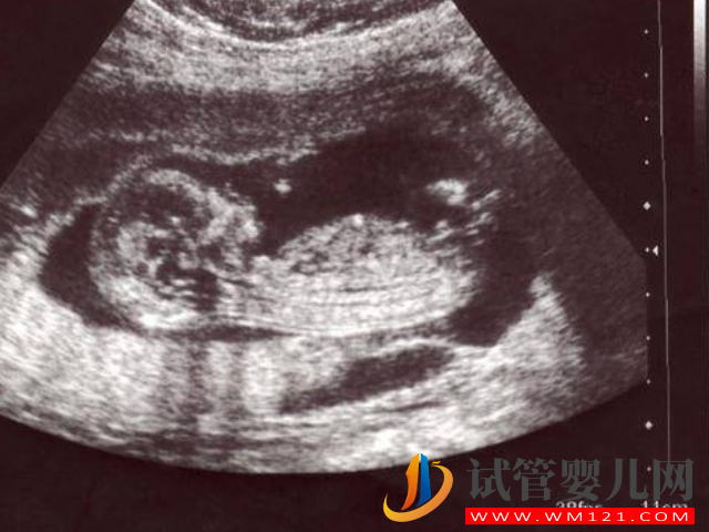 廣豐婦幼保健院四維彩超預(yù)約攻略，線上預(yù)約從容產(chǎn)檢更安心(圖1)