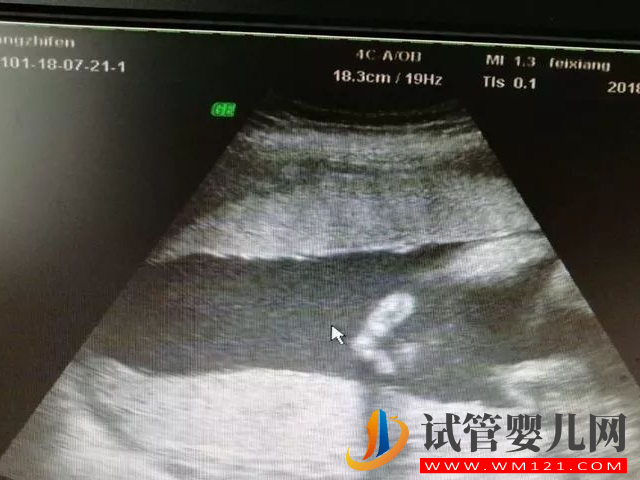 廣豐婦幼保健院四維彩超預(yù)約攻略，線上預(yù)約從容產(chǎn)檢更安心(圖2)