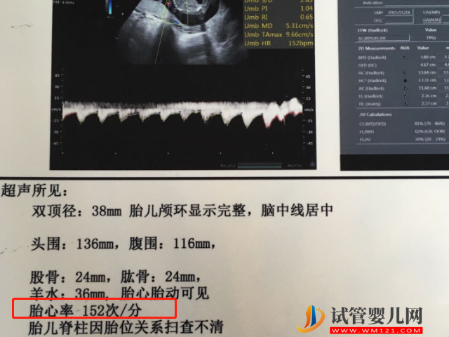 民間最靈預(yù)測(cè)生男生女方法大揭秘，舉例說(shuō)明包教你看懂！(圖4)