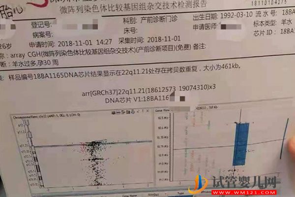第一胎2號染色體異常并非不能要孩子，能否要二胎看情況(圖2)
