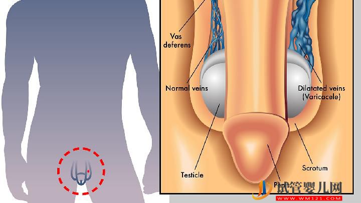 男性性功能障礙12個致病因素 五種水果能預防性功能障礙(圖3)