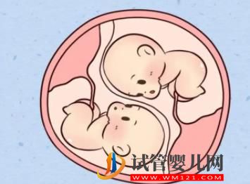 老撾磨丁做試管生雙胞胎需要什么條件(圖1)