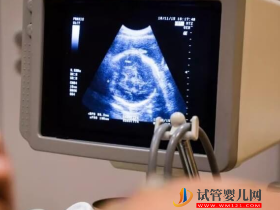 羊穿查出胚胎2號染色體基因突變會有哪些不良癥狀？(圖1)