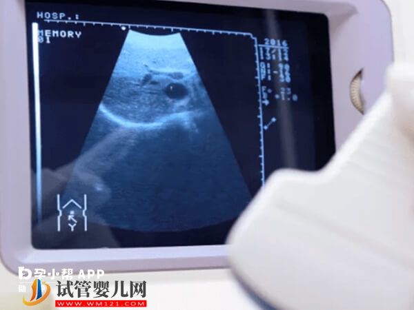 上海實(shí)力超強(qiáng)的試管嬰兒推薦，第一家妊娠率高達(dá)64%(圖2)