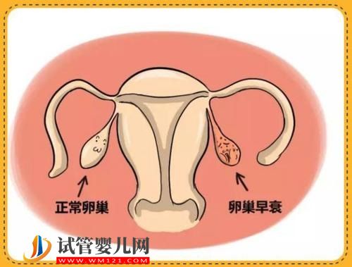 接觸有毒金屬或致女性卵巢早衰(圖1)