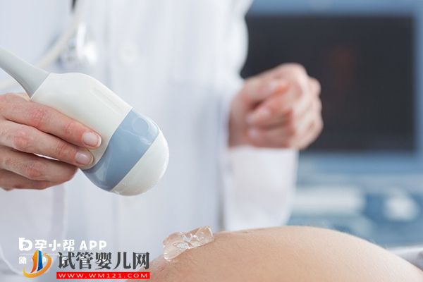 14號染色體異常跟男方有關系，做三代試管可生健康寶寶(圖1)