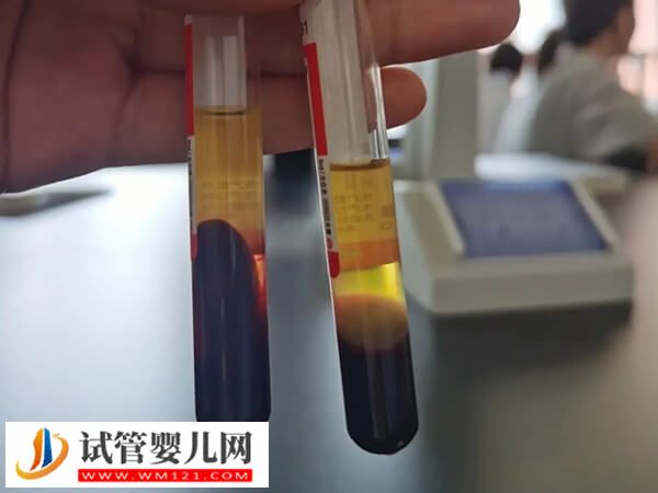 凍胚移植hcg翻倍對(duì)照表，雙胎翻倍時(shí)間居然比單胎長(zhǎng)那么多(圖3)