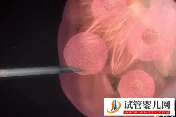誰說取卵后醫生不會發告知胚胎質量的短信，咋樣看完就造(圖1)