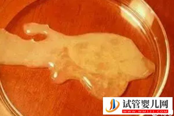 誰說取卵后醫生不會發告知胚胎質量的短信，咋樣看完就造(圖2)