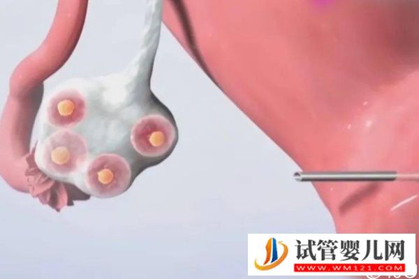 取卵后醫生會通知配成幾個胚胎，受精情況也能了解(圖1)