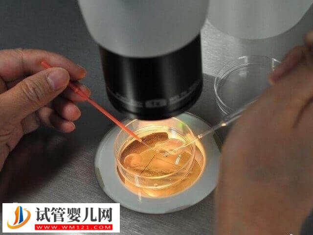 胚胎培養(yǎng)液對試管嬰兒有沒有影響(圖1)