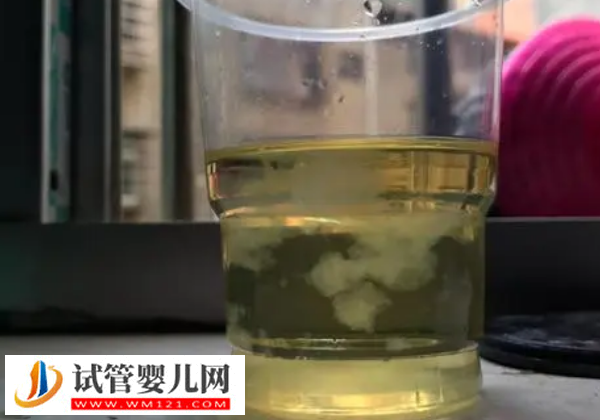 懷孕50天測男女土方法，酒精加尿液的酸堿度可以判斷(圖2)