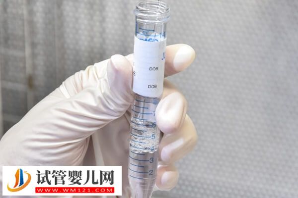 汕頭三代試管嬰兒花費(fèi)分享，促排準(zhǔn)備這個(gè)數(shù)才行！(圖2)