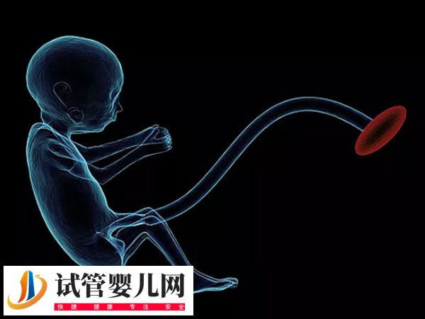 試管出生雙胞胎的健康與什么有關(圖1)