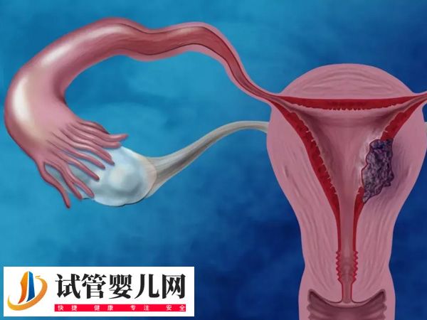 攀枝花試管醫院哪家好(圖2)