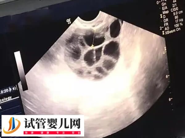 絕經(jīng)了還能不能做試管嬰兒(圖2)