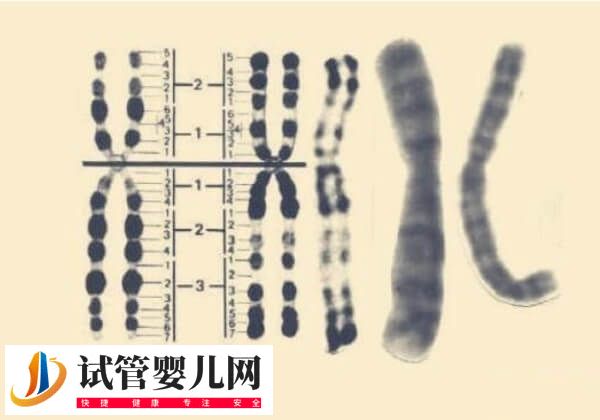 Y染色體微缺失能否做試管(圖2)
