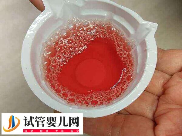 做試管胎停是胚胎質量問題(圖1)