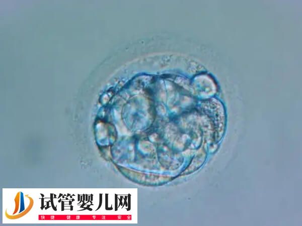 移植后胚胎質(zhì)量不好是什么原因(圖1)