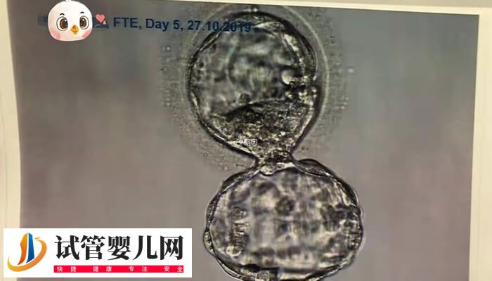 移植后胚胎質(zhì)量不好是什么原因(圖2)