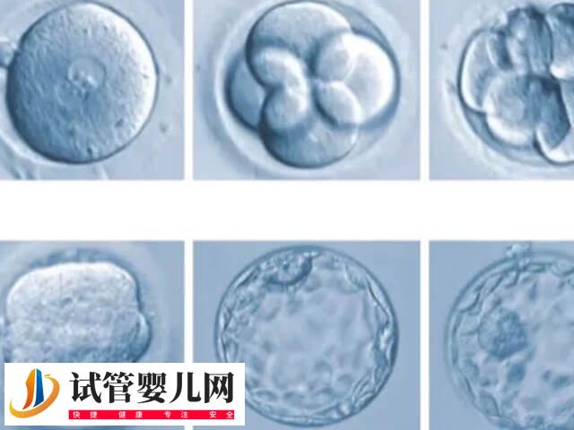 囊胚移植有什么優(yōu)點(diǎn)(圖1)