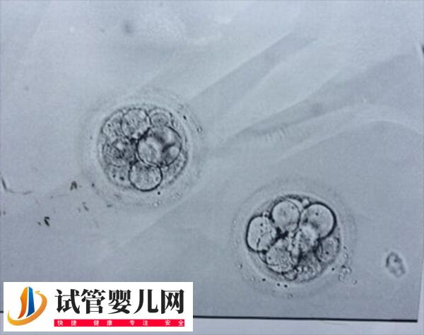 4bc囊胚移植成功率高不高(圖2)