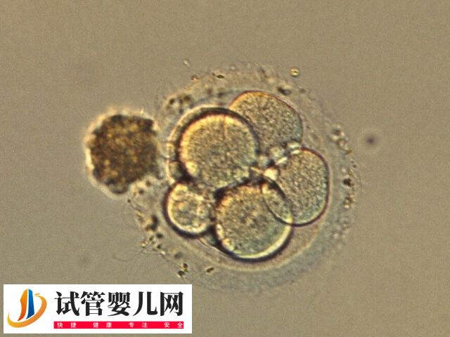 體外培養(yǎng)7天的囊胚質(zhì)量怎么樣(圖1)
