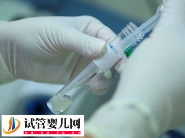 試管取卵前排精注意什么事項(xiàng)(圖2)