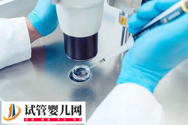 取卵后腹痛正不正常(圖2)
