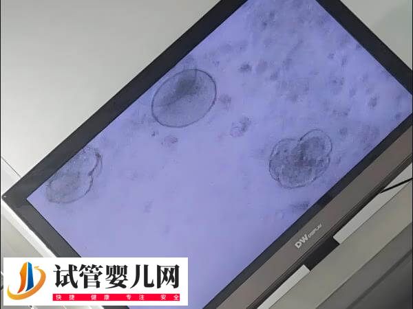 沒達到冷凍標準的囊胚能否移植(圖1)