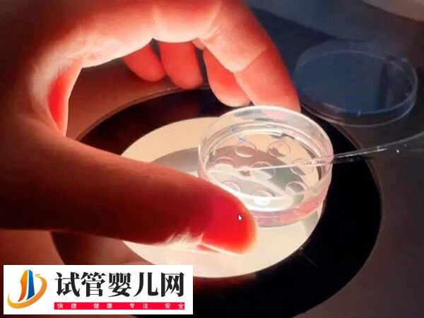 做試管胚胎是如何移植的(圖2)