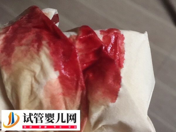 試管移植失敗后有什么癥狀(圖1)