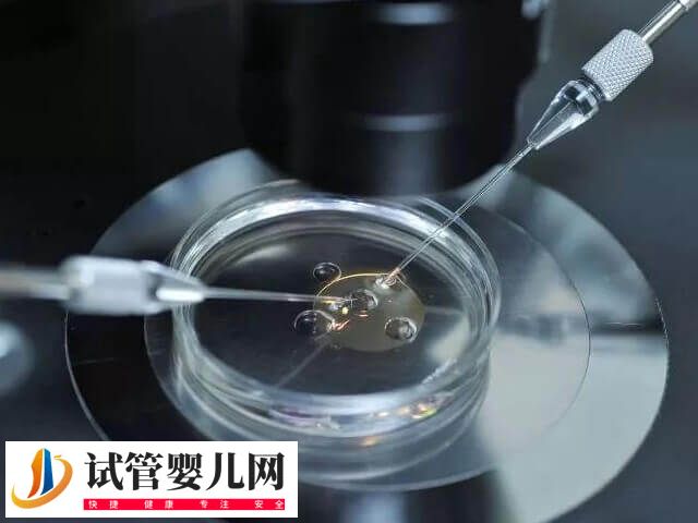 試管移植后身體會有什么反應