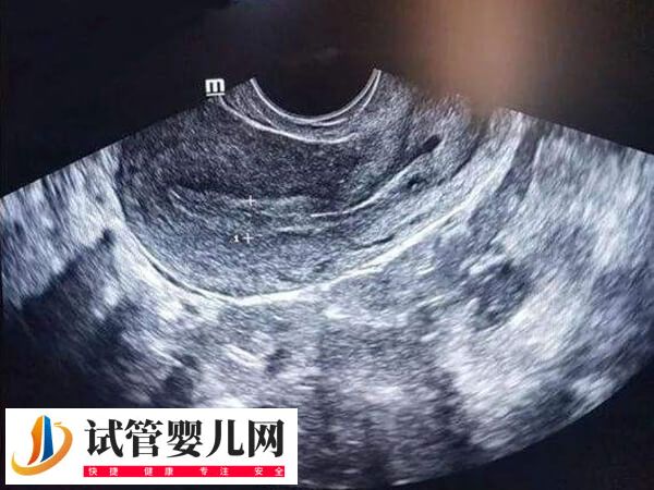 深圳三代試管的醫院有哪些(圖3)