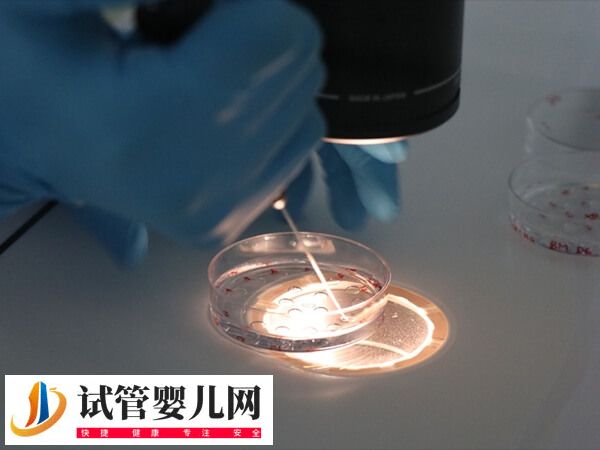 3代試管嬰兒能否排除唇腭裂(圖2)