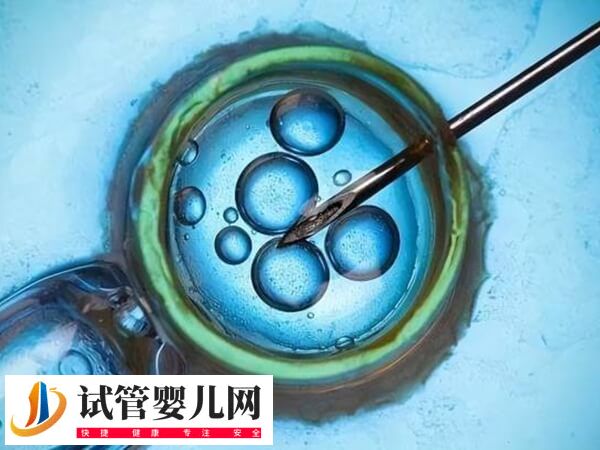 謹(jǐn)慎移植的成功率有多少