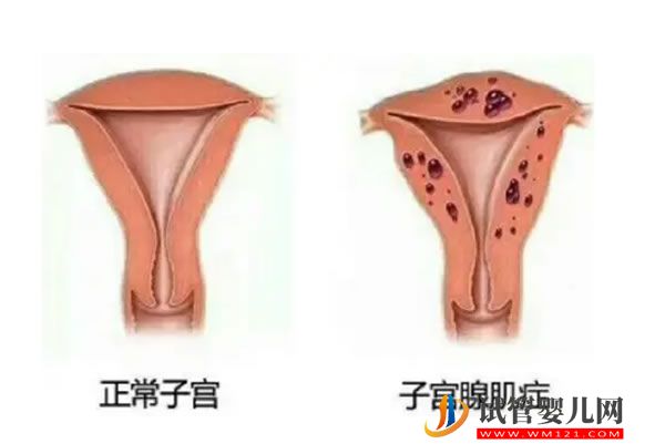 格魯吉亞和烏克蘭試管嬰兒那個好?看到這些原因就一目了然 (圖1)